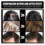 FORT Minoxidil Hair Growth Spray - Hair Tonic for Hair Care and Hair Growth - Premium Hair Care Product Women and Men all Hair Types