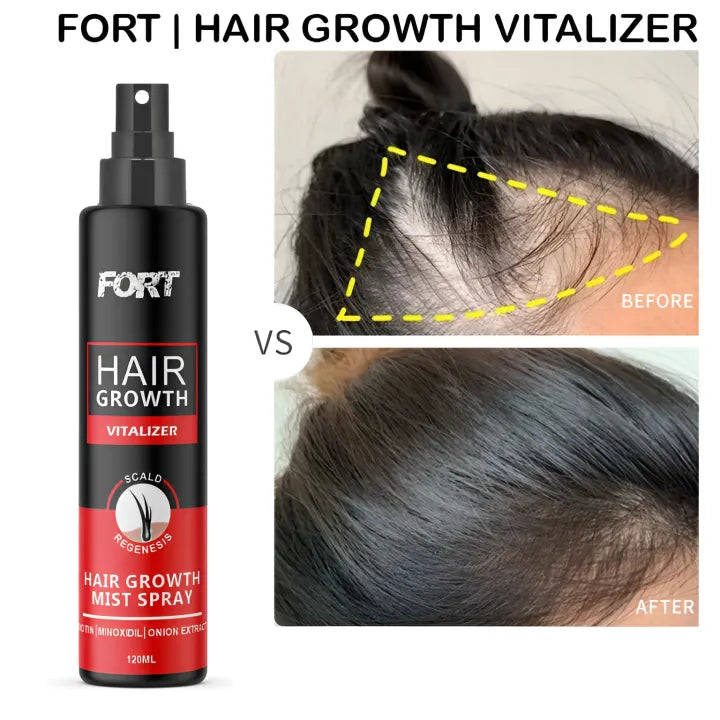 FORT Minoxidil Hair Growth Spray - Hair Tonic for Hair Care and Hair Growth - Premium Hair Care Product Women and Men all Hair Types